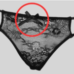 Understanding Bulging Veins: Causes, Health Implications, and What You Should Know