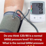 5 Health Conditions That Can Cause Visible Veins — What Your Body Might Be Signaling